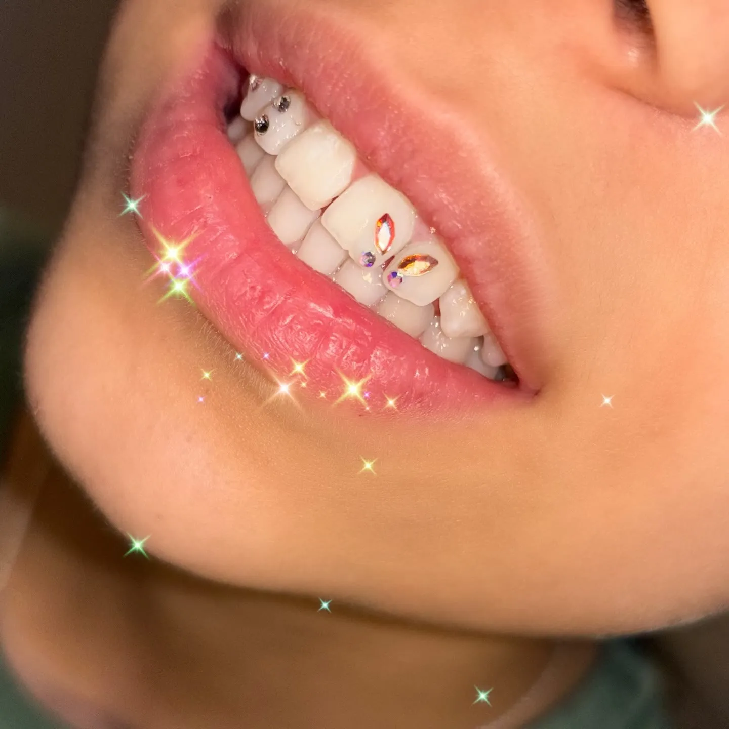 Szkolenie Tooth Gems